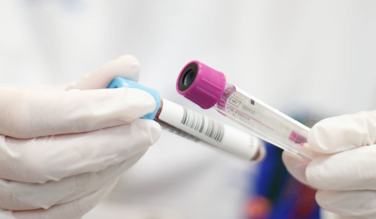 En person som håller i provrör