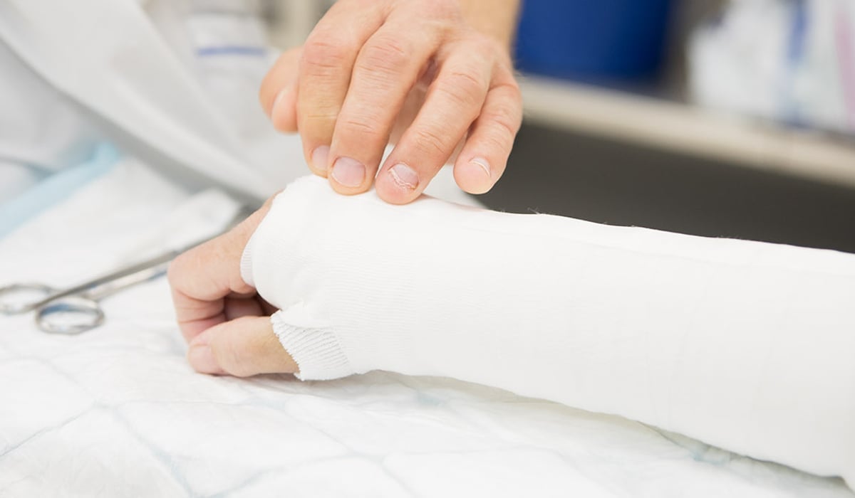 En person med gips på armen